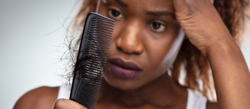 Como tratar queda de cabelo pós covid-19